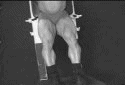 Hack squats